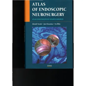 Atlas of endoscopic neurosurgery Zdeněk Novák Jan Chrastina...