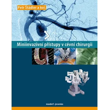Miniinvazivní přístupy v cévní chirurgií Petr Štádler