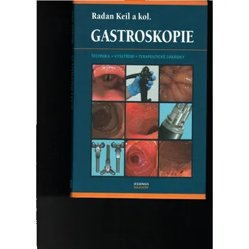 Kniha Gastroskopie Radan Keil