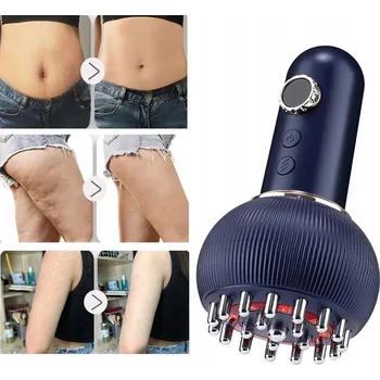 Masážní přístroj ELEKTRYCZNA BAŃKA CHIŃSKA S VYHŘÍVÁNÍM – MASÁŽNÍ PŘÍSTROJ NA CELULITIDU