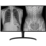 Lékařský monitor LG 32HL512D-B / 31,5" / 4K Ultra HD / doba odezvy 14 ms / černá