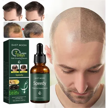 Vlasová regenerace SÉRUM PRO RŮST VLASŮ, PŘÍRODNÍ OLEJ PROTI VYPADÁVÁNÍ VLASŮ