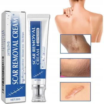 Celulitida a strie Silikonový gel na odstraňování jizev