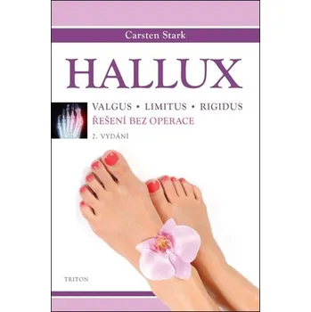 Hallux - Řešení bez operace, 2. vydání