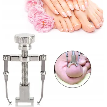 SPONA NA ZARŮSTAJÍCÍ NEHTY, ZAROSTLÝ NEHET U NOHY