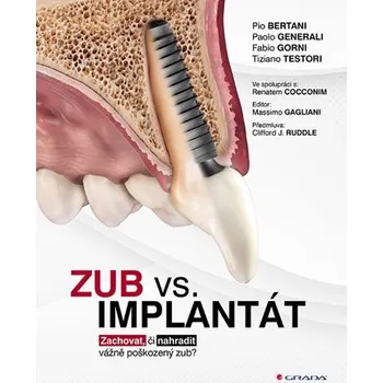 Zub vs. implantát