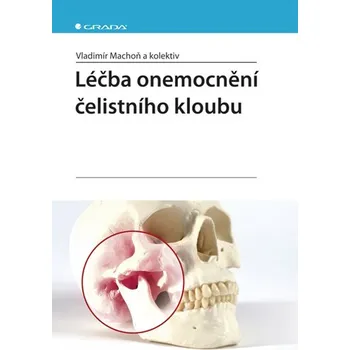 Léčba onemocnění čelistního kloubu