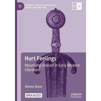 Hurt Feelings - Skuse, Alanna