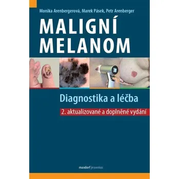 Maligní melanom - Diagnostika a léčba - Arenbergerová Monika