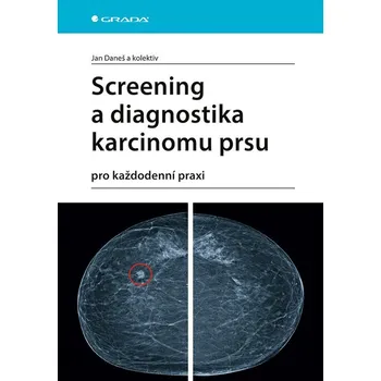Kniha Screening a diagnostika karcinomu prsu Ekniha