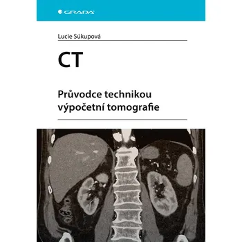 CT - Průvodce technikou výpočetní tomografie Ekniha