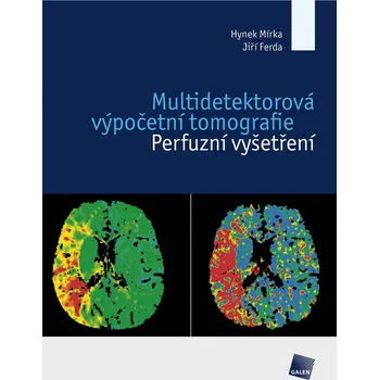Kniha Multidetektorová výpočetní tomografie Ekniha