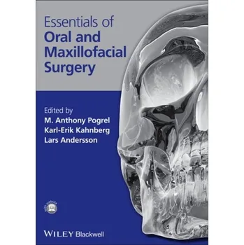 Essentials of Oral and Maxillofacial Surgery