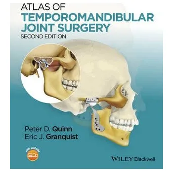 Kniha Atlas of Temporomandibular Joint Surgery