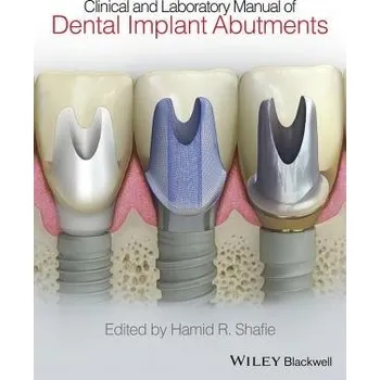 Clinical and Laboratory Manual of Dental Implant Abutments - Shafie, Hamid R. (President, American Institute of Implant Dentistry, Washington, DC, USA)
