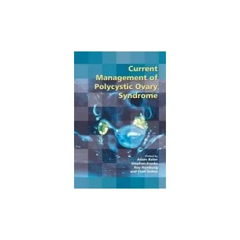 Current Management of Polycystic Ovary Syndrome