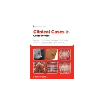 Clinical Cases in Orthodontics - Cobourne, Martyn T. (Honorary Consultant in Orthodontics, Guy's and St Thomas' NHS Foundation Trust Dental Institute, London) a Fleming, Padhraig S. (Queen Mary University of London, UK) a DiBiase, Andrew T. (Consultant Or