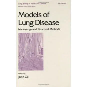 Kniha Models of Lung Disease - Gil, Joan