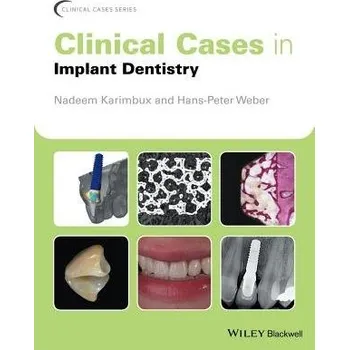 Clinical Cases in Implant Dentistry
