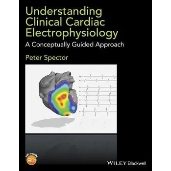 Understanding Clinical Cardiac Electrophysiology - Spector, Peter (University of Vermont College of Medicine, Burlington, VT, USA)