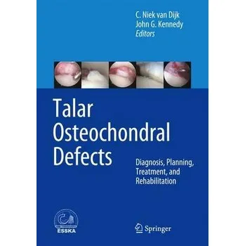 Talar Osteochondral Defects