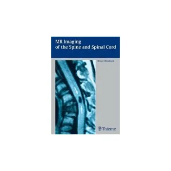 MR Imaging of the Spine and Spinal Cord - Uhlenbrock, Detlev
