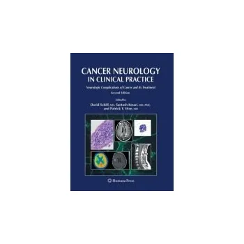 Cancer Neurology in Clinical Practice