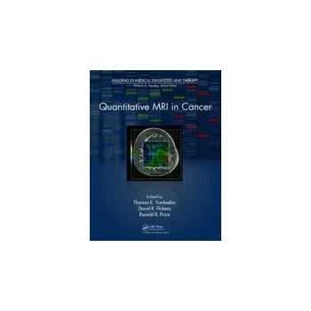 Quantitative MRI in Cancer