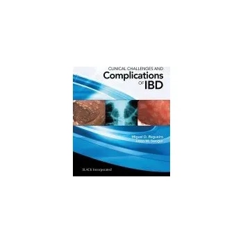 Clinical Challenges and Complications of IBD - Regueiro, Miguel a Swoger, Jason