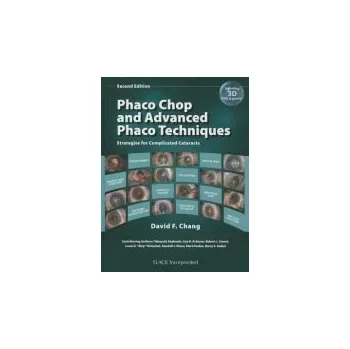 Phaco Chop and Advanced Phaco Techniques - Chang, David F.