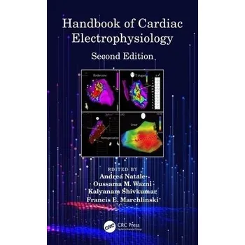 Handbook of Cardiac Electrophysiology