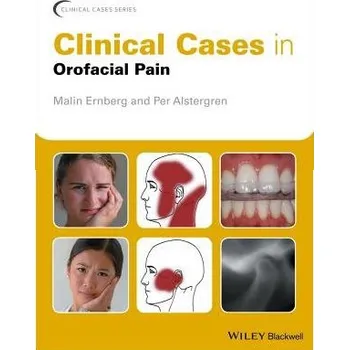 Clinical Cases in Orofacial Pain - Ernberg, Malin (Karolinska Institutet, Sweden) a Alstergren, Per (Malmo University, Sweden)