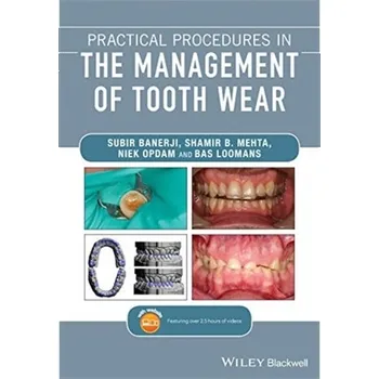 Practical Procedures in the Management of Tooth Wear - Banerji, Subir; Mehta, Shamir B.; Opdam, Niek; Loomans, Bas
