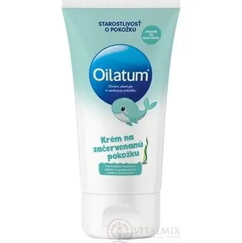 Oilatum krém na zarudlou pokožku 100 ml