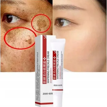 Pleťový krém Krém na Odstranění Pigmentových Skvrn, Bělící Krém