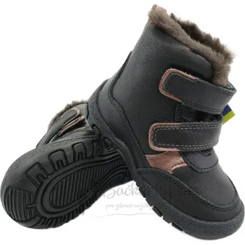 Dívčí obuv Zimní dětská obuv Protetika Daira - vel. 21