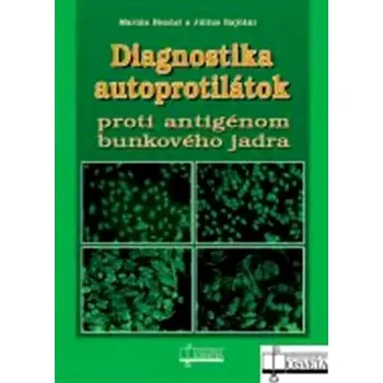 Diagnostika autoprotilátok proti antigénom bunkového jadra (Marián Benčat, 2013)