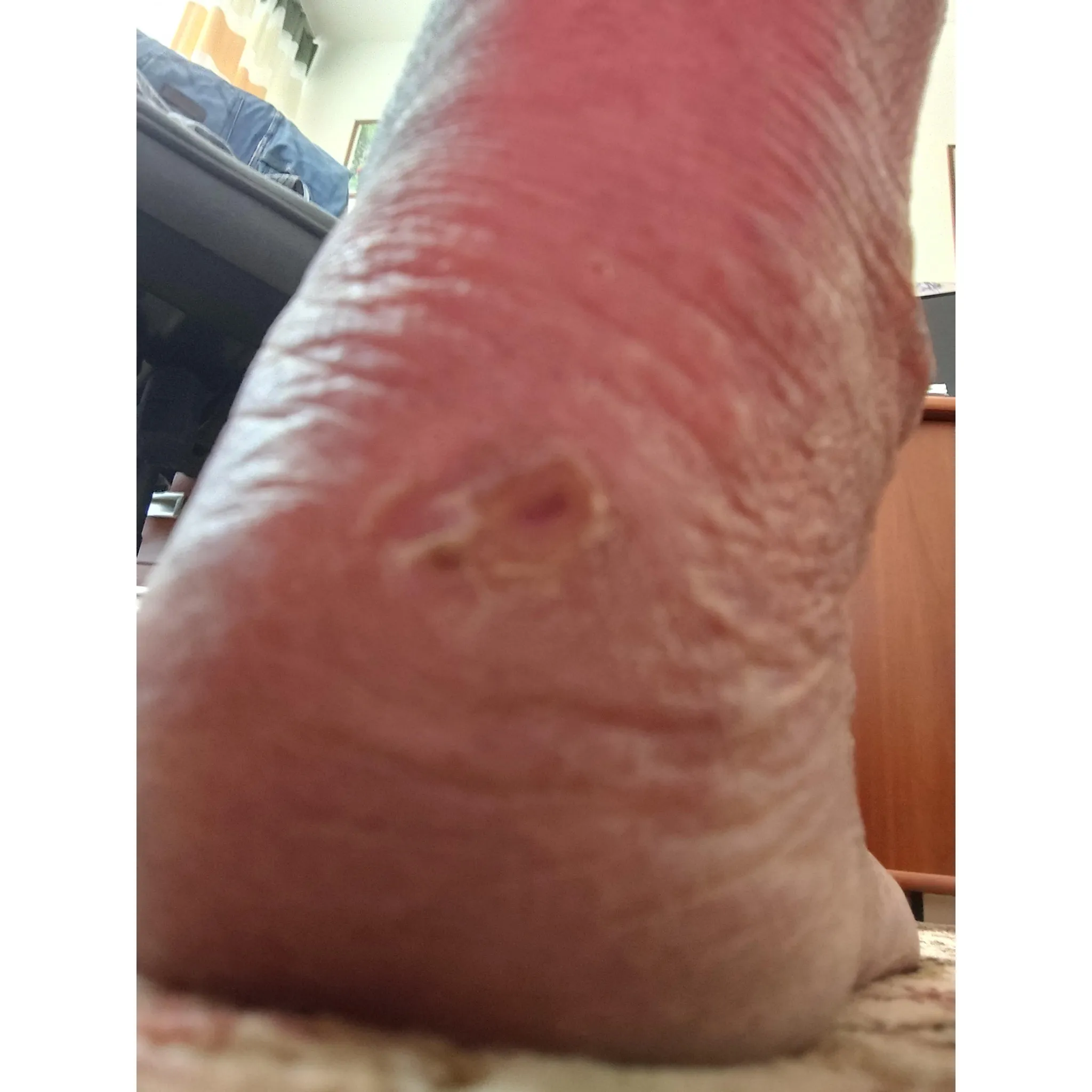 Fotografie 5 - Bylinná léčivá mast ActiMaris Gel na rány 20 g