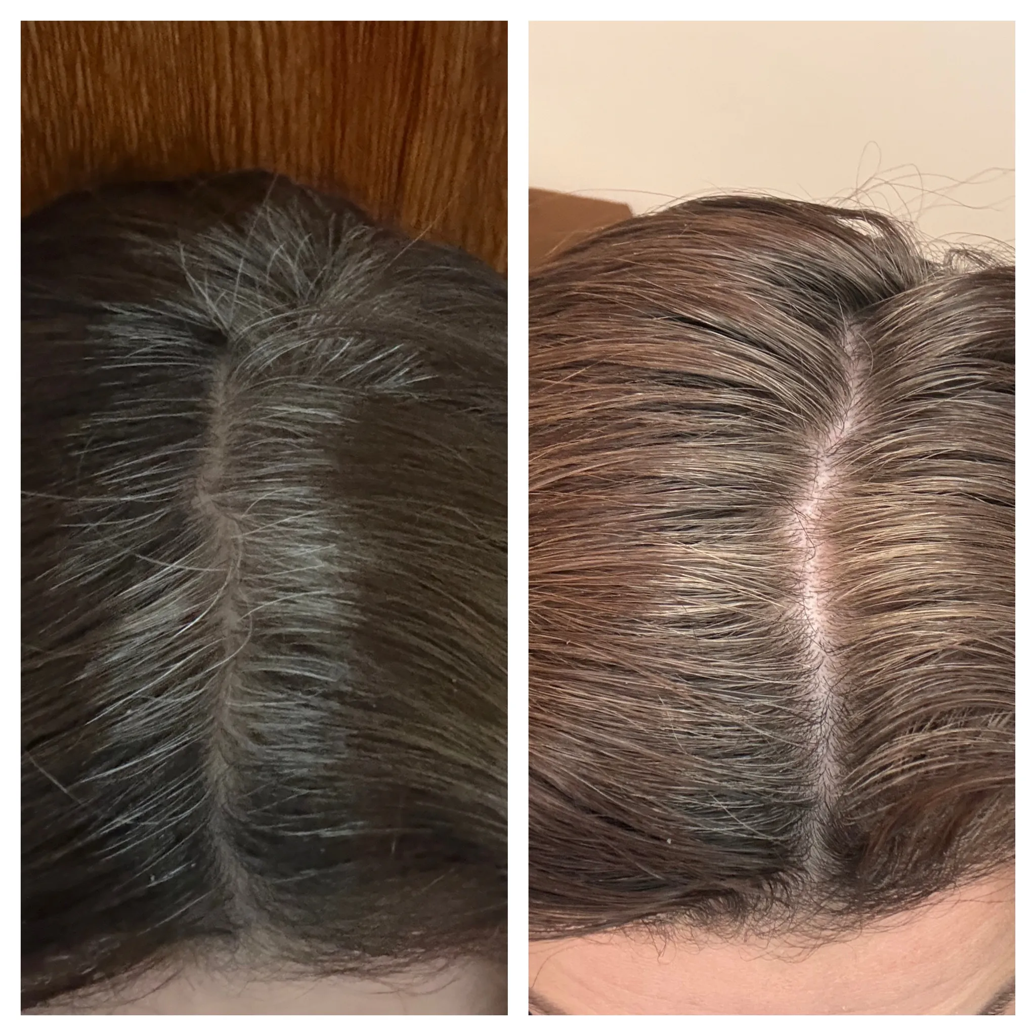 Fotografie 2 - Vlasová regenerace GR-7 Professional Real Shades of Hair proti šedinám 125 ml