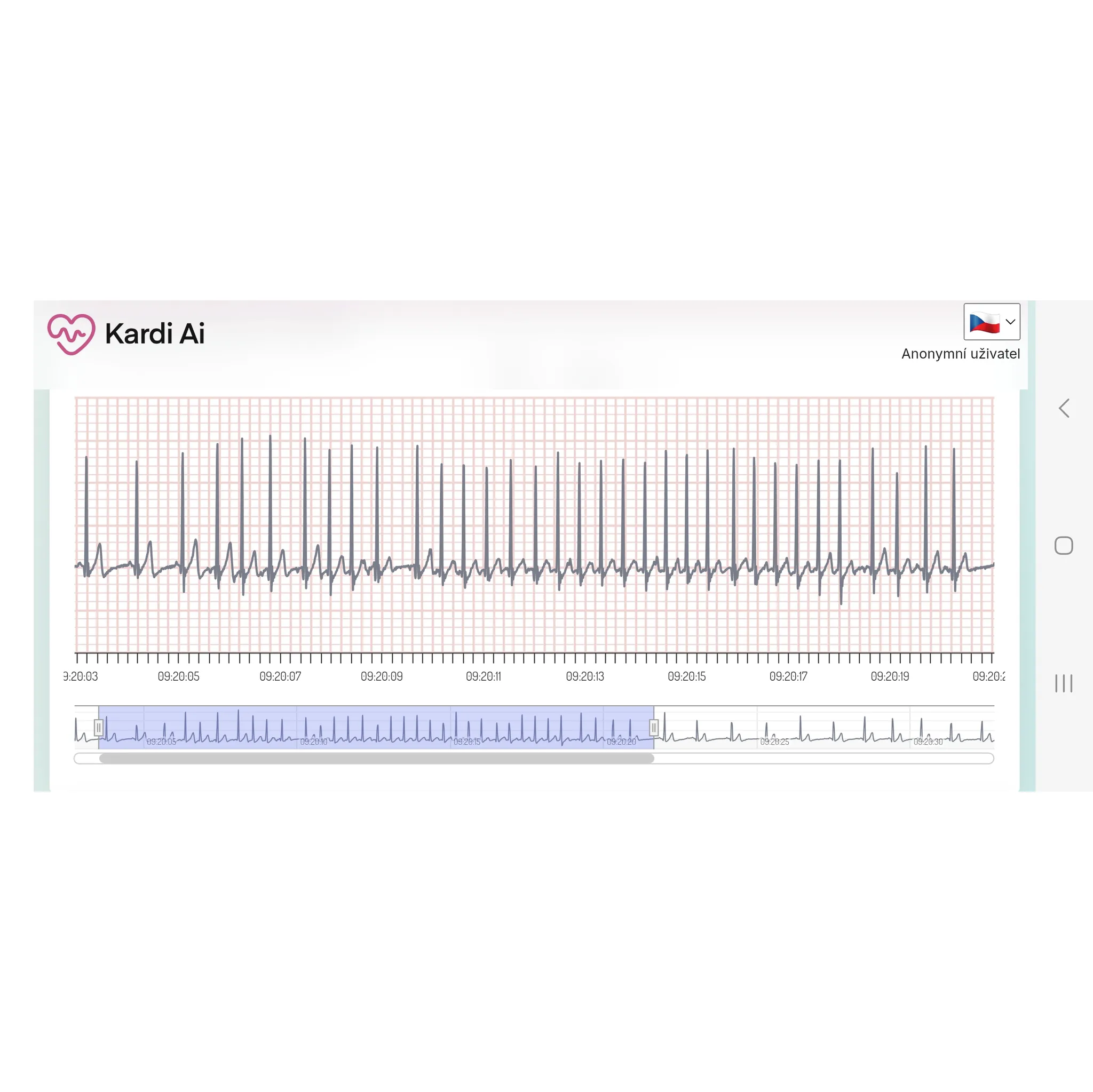 Fotografie 2 - Diagnostický test Kardi Ai Dlouhodobý monitoring srdce XXXL + předplatné 12 měsíců