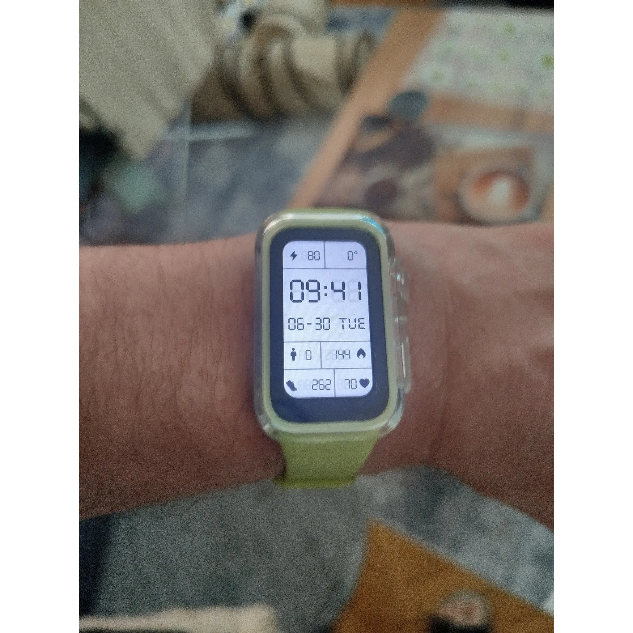 Fotografie 6 - Fitness náramek Xiaomi Smart Band 9 Active černý