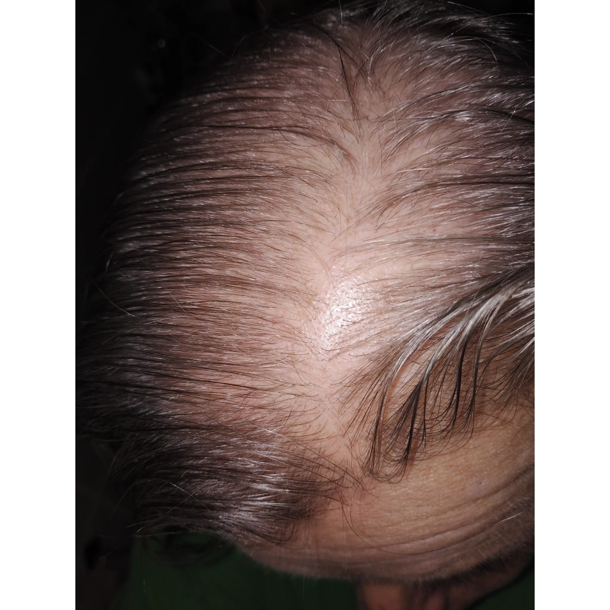Fotografie 3 - Přípravek proti padání vlasů Navlasil Sérum proti vypadávání vlasů a šedivění 50 ml