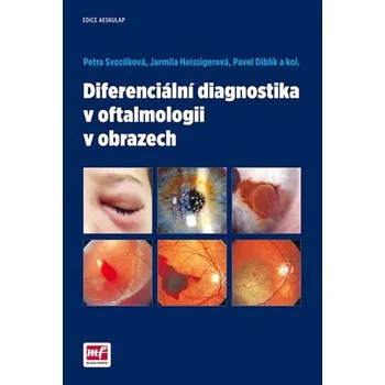 Diferenciální diagnostika v oftalmologii v obrazech - Petra Svozílková