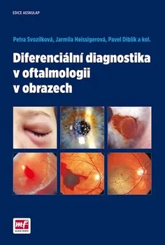 Diferenciální diagnostika v oftalmologii v obrazech - Petra Svozílková