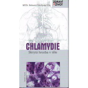 Chlamydie: Skrytá hrozba v těle - Bohumil Ždichynec