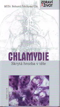 Chlamydie: Skrytá hrozba v těle - Bohumil Ždichynec