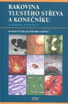 učebnice Rakovina tlustého střeva a konečníku - Rostislav Vyzula; Jan Žaloudík