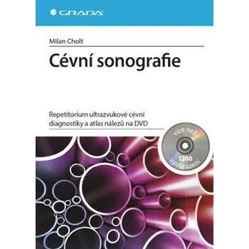 Cévní sonografie: repetitorium…