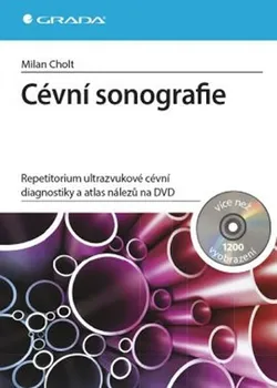 Cévní sonografie: repetitorium ultrazvukové cévní diagnostiky - Milan Cholt