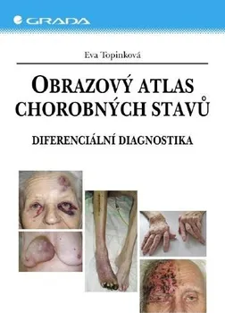 Kniha Obrazový atlas chorobných stavů - Eva Topinková [E-kniha]